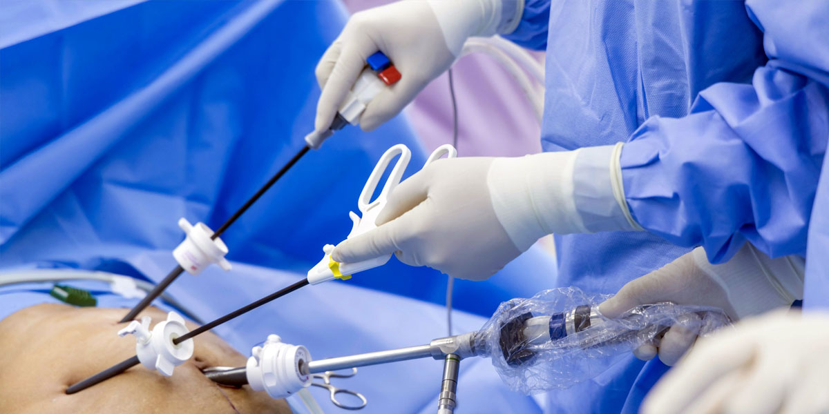 how-safe-is-laparoscopic-surgery